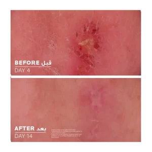 La Roche Posay Cicaplast Baume B5 Healing Balm 40ml - Image 5